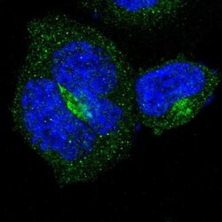 B4GALT3 Antibody, Novus Biologicals:Antibodies:Primary Antibodies
